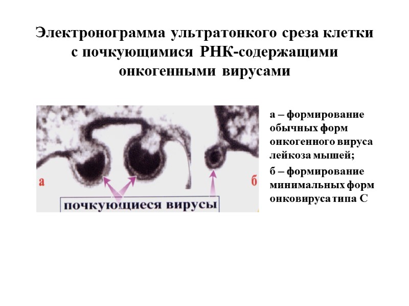 Электронограмма ультратонкого среза клетки с почкующимися РНК-содержащими онкогенными вирусами а – формирование обычных форм